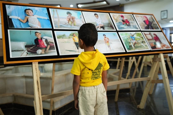 المشروع السعودي مسام يفتتح معرضا للصور في مارب لاستعراض جانب من ضحايا الألغام في اليمن