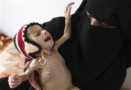 مسؤول أممي: عشرة مليون يمني على بعد خطوة من المجاعة